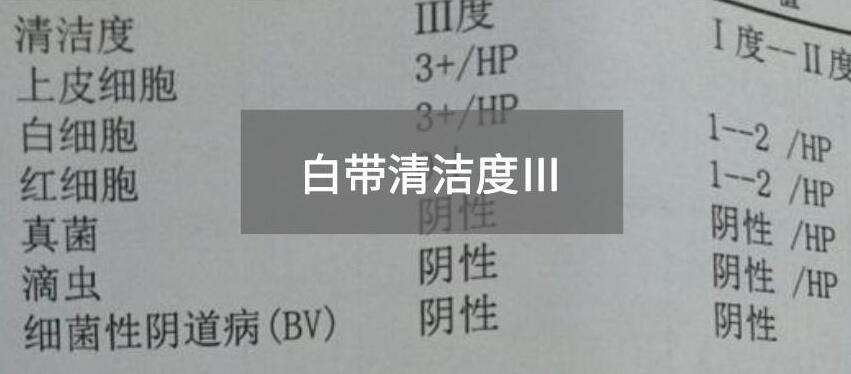 今天快讯！全自动白带在线观看香蕉视频生产厂家911香蕉视频APP为您官方解释白带清洁度3的意思