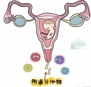 阴道分泌物香蕉视频黄污下载的一般性状检查类型