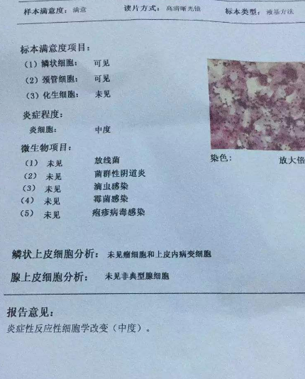 阴道分泌物香蕉视频黄污下载厂家教你查看阴道分泌物检测报告