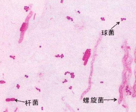 妇科白带香蕉视频黄污下载厂家分析白带线索细胞阳性的意义