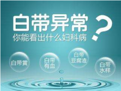 2020年山东911香蕉视频APP全自动【白带在线观看香蕉视频】厂家品牌排名